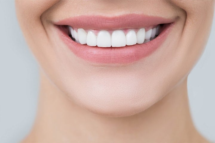 Velg mellom en eller to kjever tannbleking hos Strømmen Tannklinikk Pluss