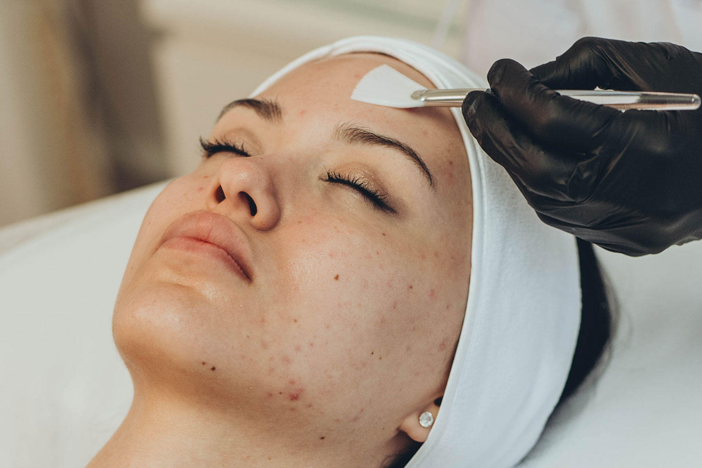 Hudföryngrande ansiktsbehandling Jalupro Glow Peel hos Lounge of Beauty