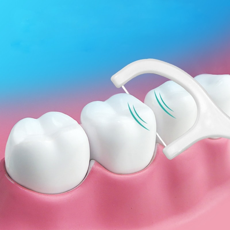 Tandtrådsbågar 100-pack – Stark Tråd för Renare Tänder (3 av 11)