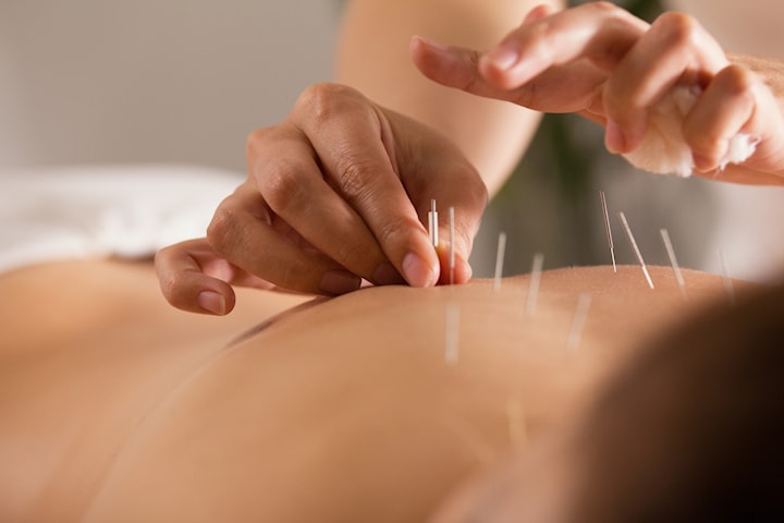 Akupunktur och massage hos Östermalms akupunktur