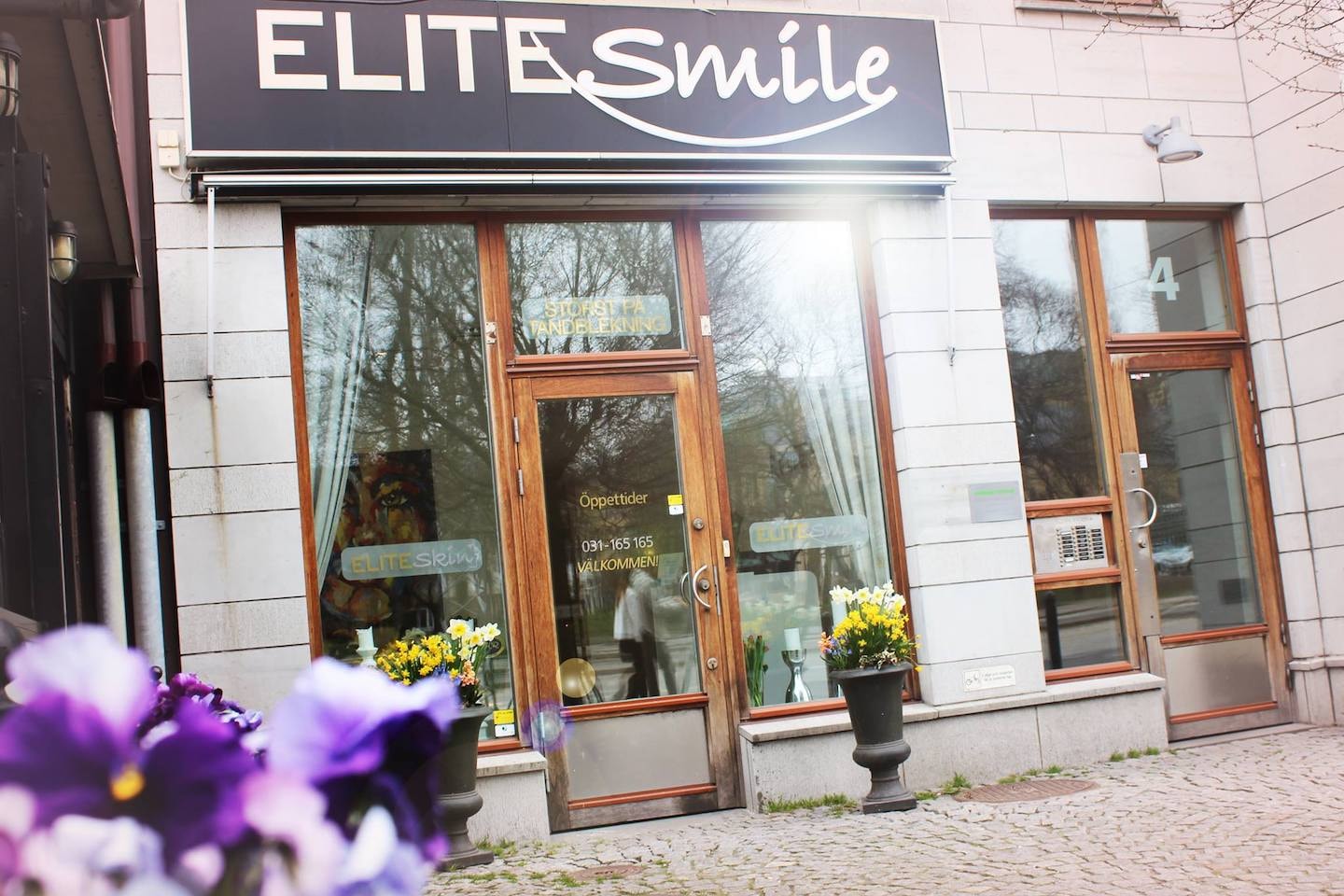 Tandblekning hos Elite Smile (1 av 4)