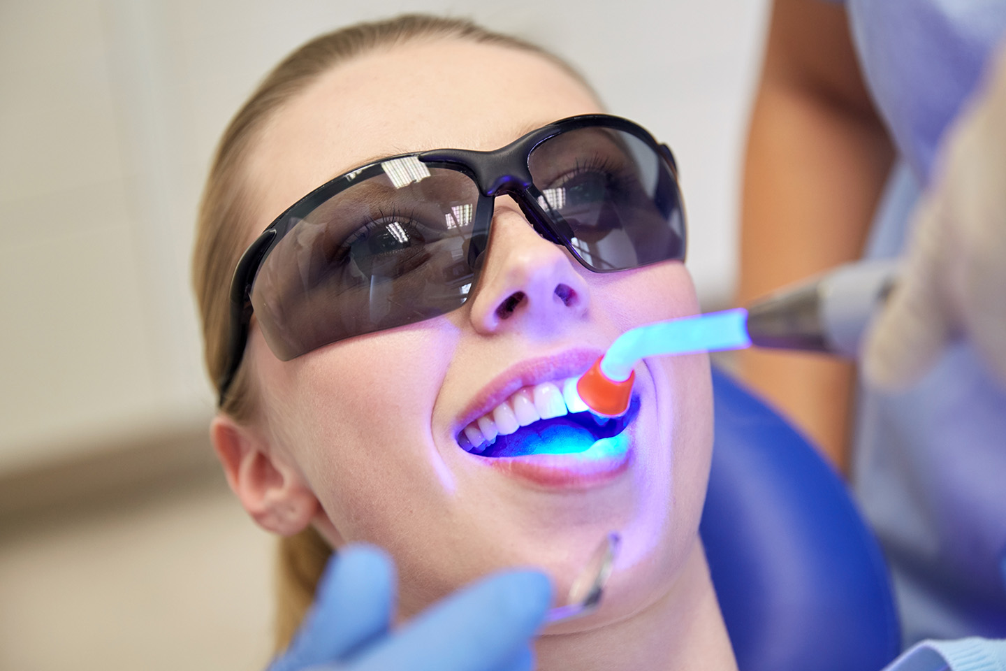 Tandblekning hos Clinica i Sundbyberg