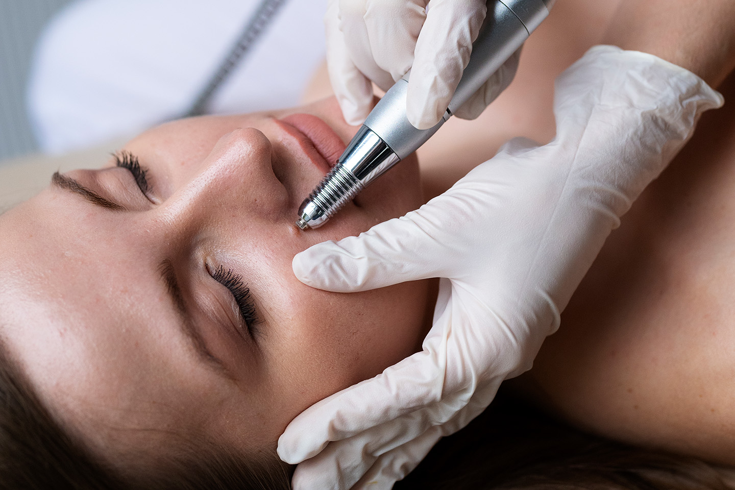 Föryngrande Full Face Carboxy behandling, 2 tillfällen