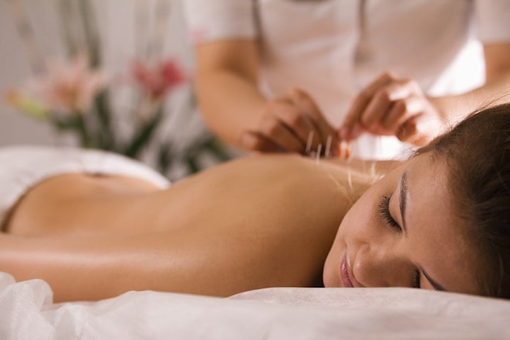 Massage och akupunktur 70 min hos Kinaterapi