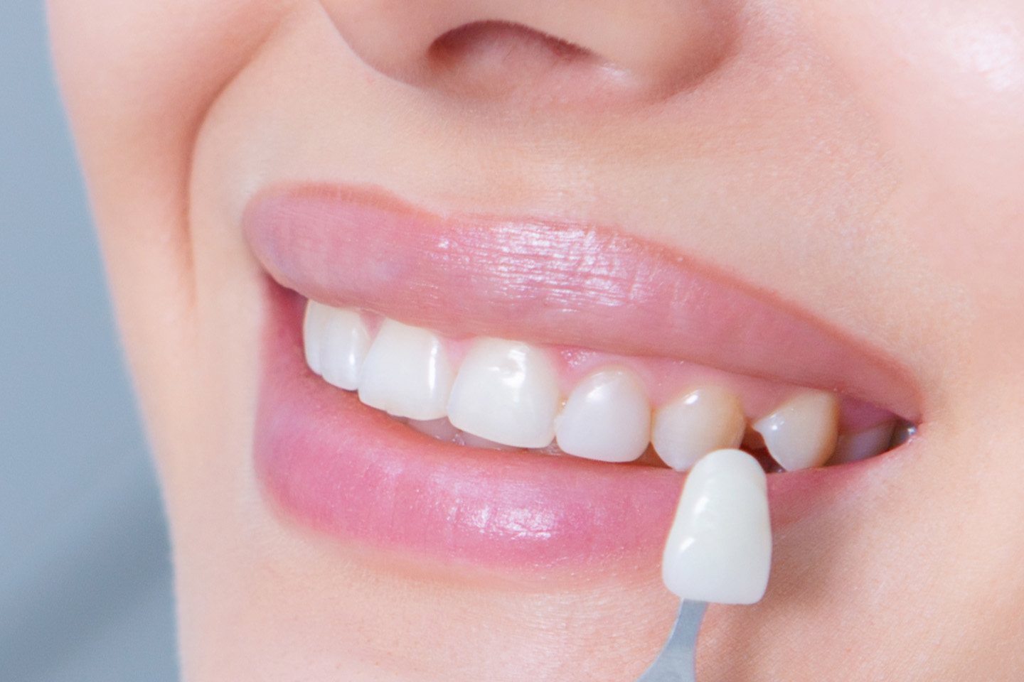 10 st tandfasader hos Implant & Esthetic Center