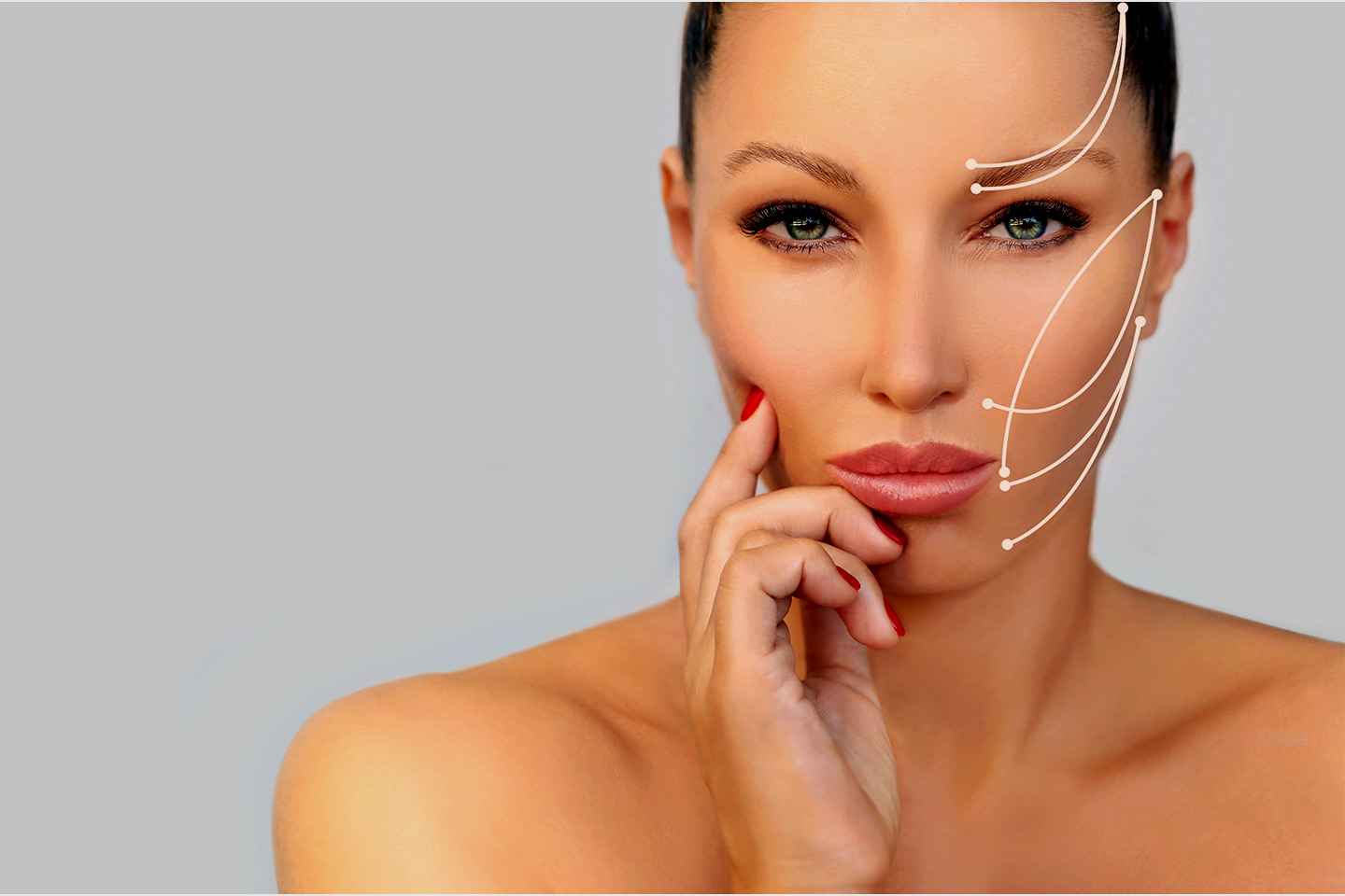 Trådløft - ansiktsløft uten kirurgi og arr hos Kosmetisk Lege