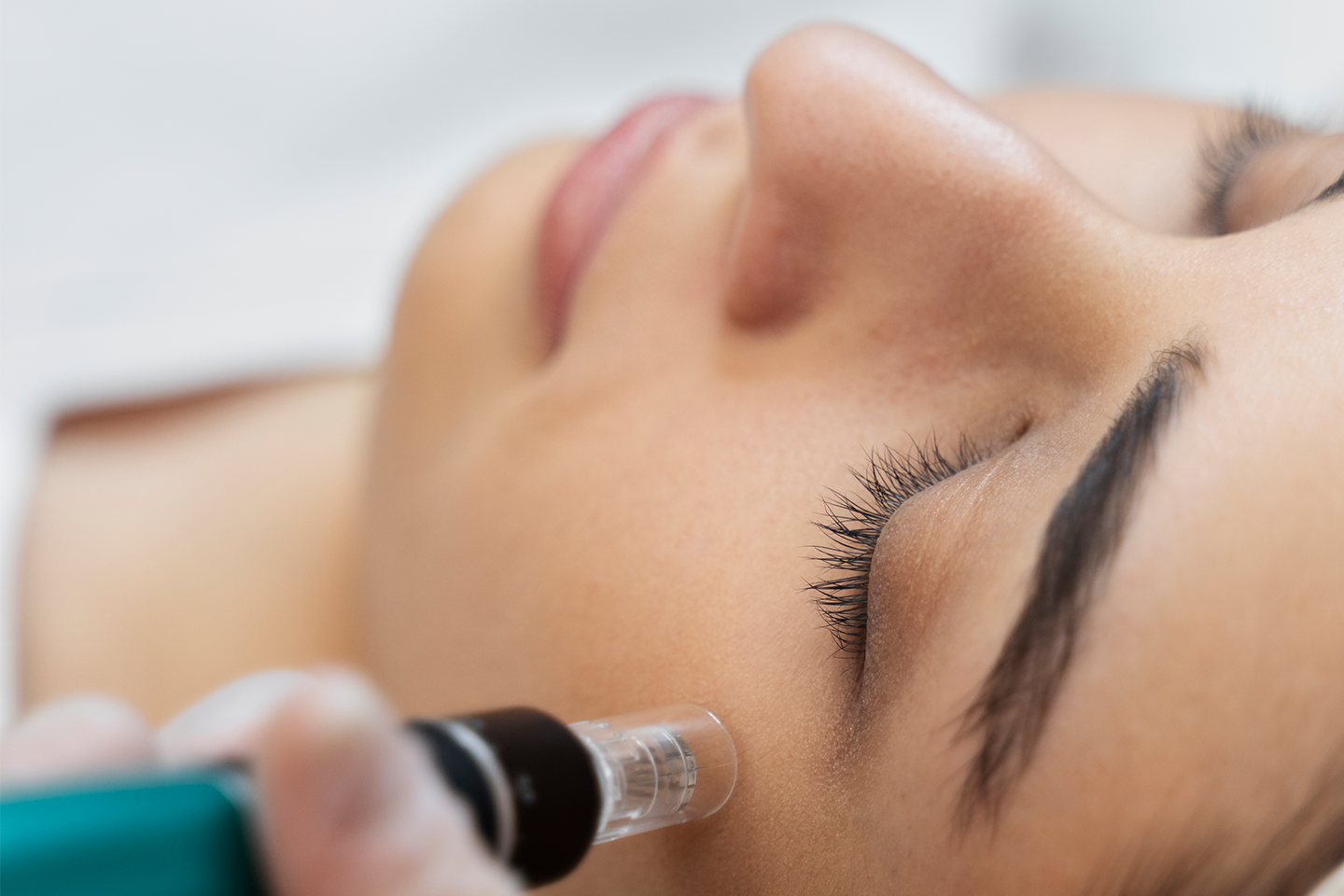 ECPR Eye complex behandling hos SB Beauty Clinic i Sundbyberg