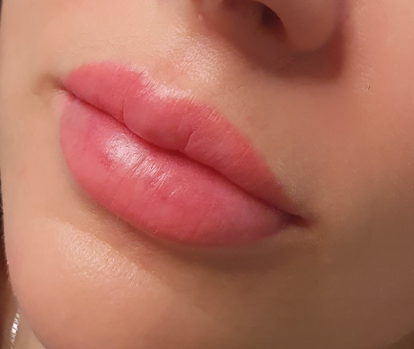 Kosmetisk läpptatuering- Lip blush (3 av 6)