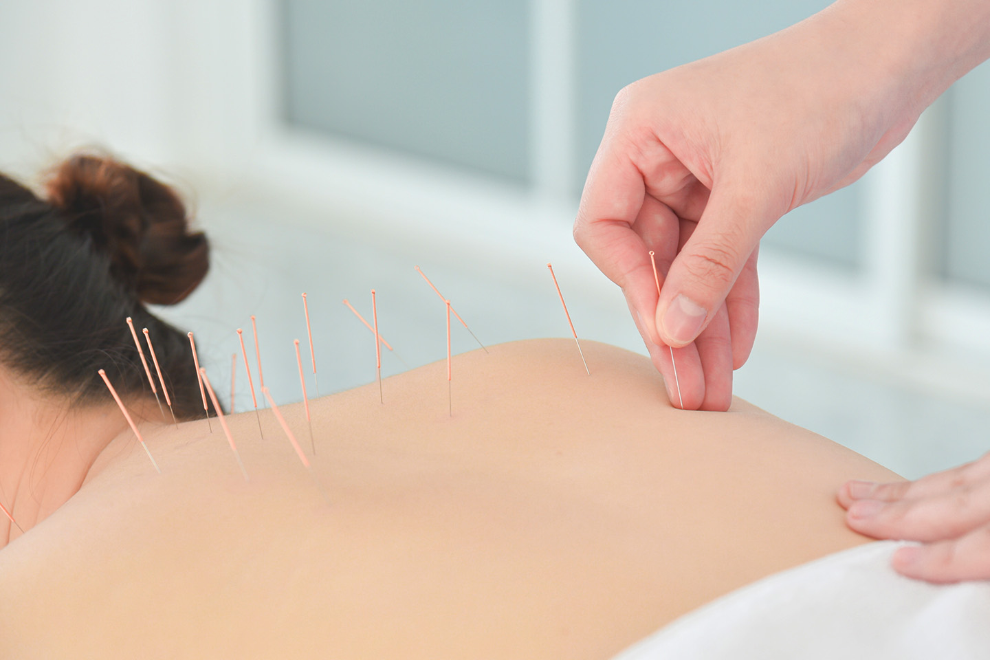 Akupunktur för smärtlindring och spänningar 55 minuter i Kvillebäcken