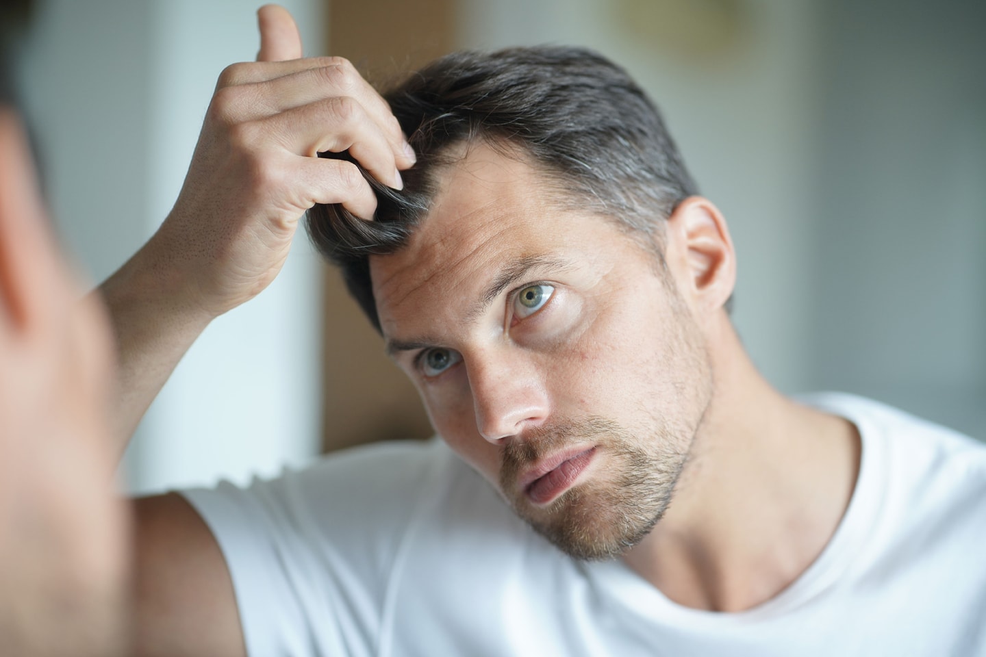 Mesoterapi mot håravfall för män och kvinnor (1 av 3)