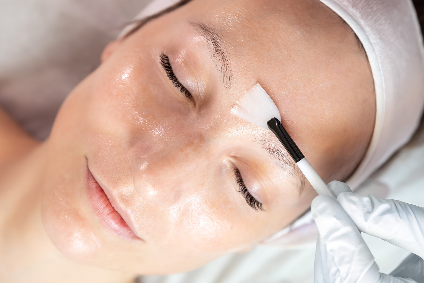 Kemisk peeling hos Basaran Aesthetics Sundbyberg