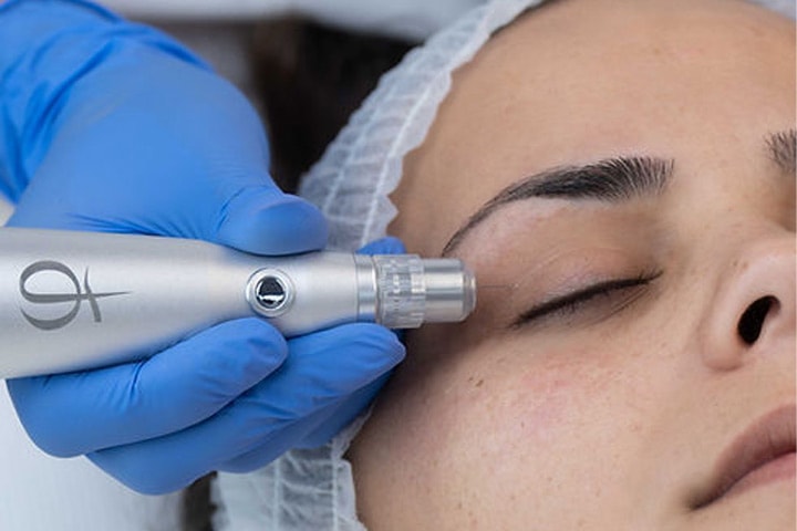 Plasma Pen - Behandla lös hud & hudförändringar hos Beauty Phix Center