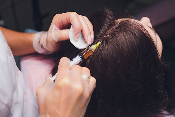 PRP-behandling för ökad hårtillväxt hos Injektionskliniken i Nacka