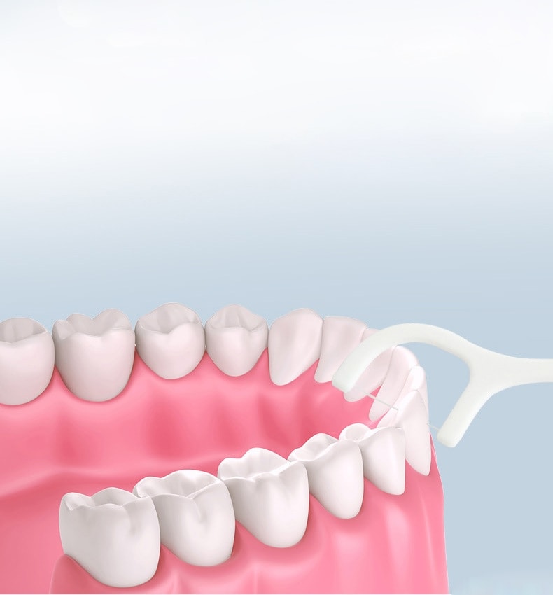 Tandtrådsbågar 100-pack – Stark Tråd för Renare Tänder (4 av 11)