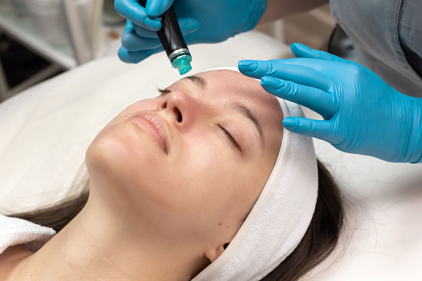 Microneedling med lax-DNA hos Relook Group nära Triangeln