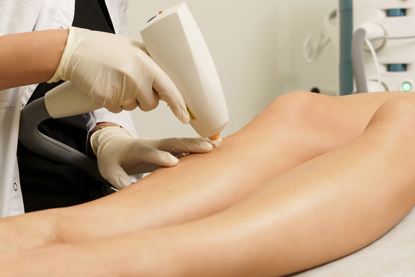 Permanent hårborttagning med laser 1-3 tillfällen hos Skinova Laser