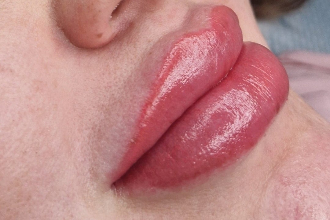 Kosmetisk läpptatuering- Lip blush (1 av 3)