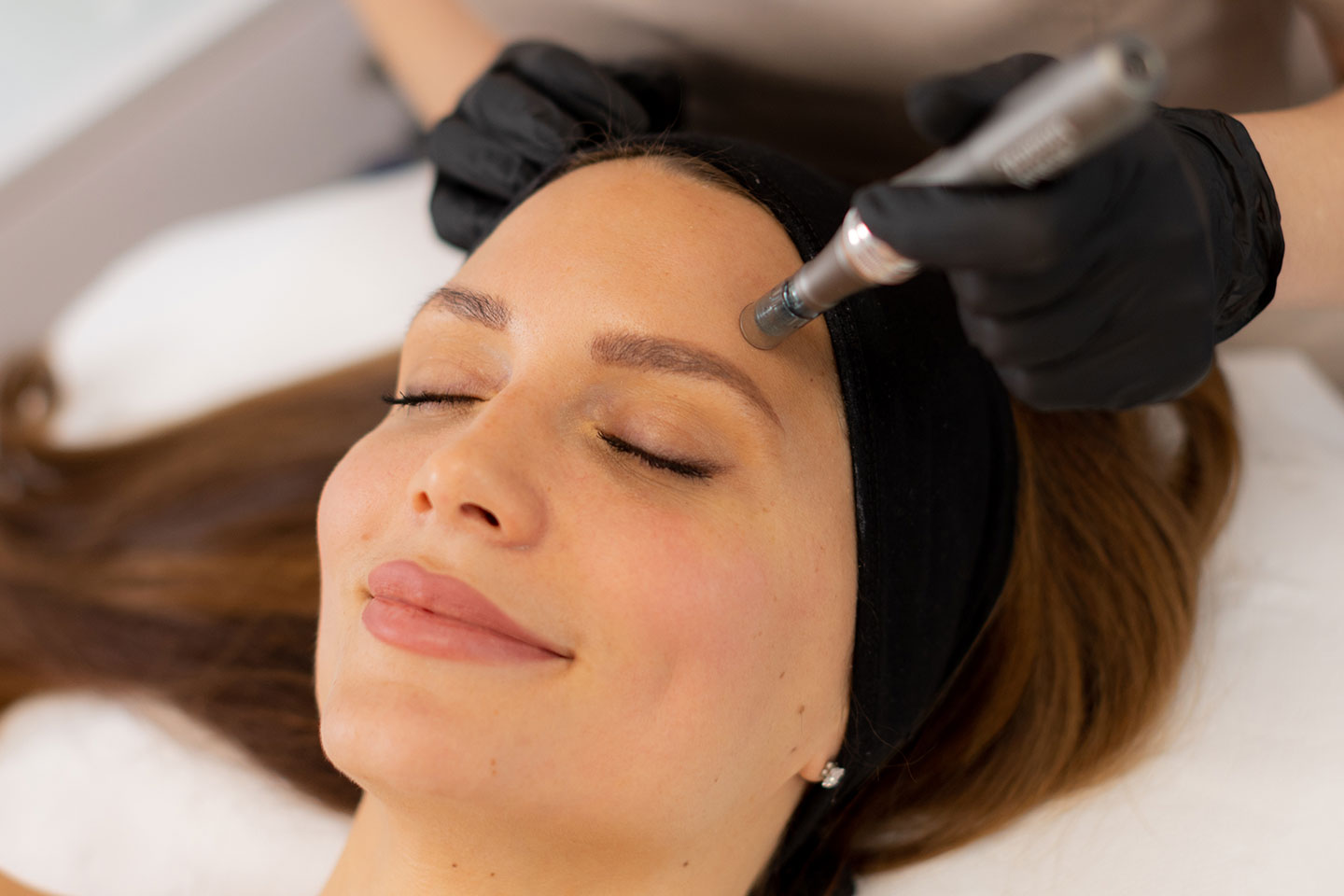 Microneedling med kollagenkräm, serum och ansiktsmask vid Vasa