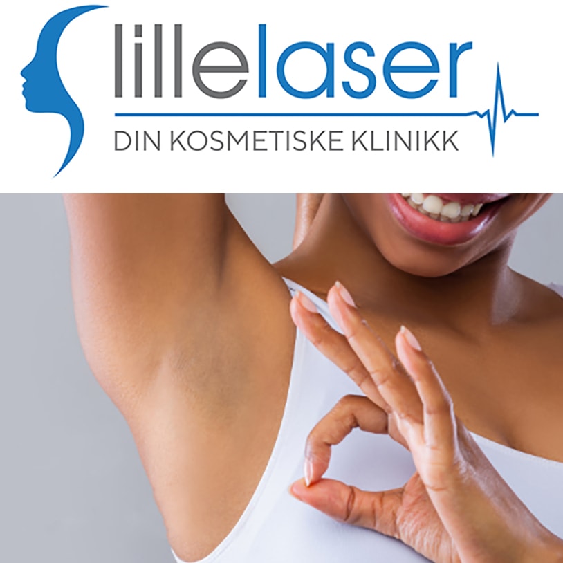 Permanent hårfjerning m/ laser - Opp til 5 behandlinger hos Lillelaser (6 av 7)