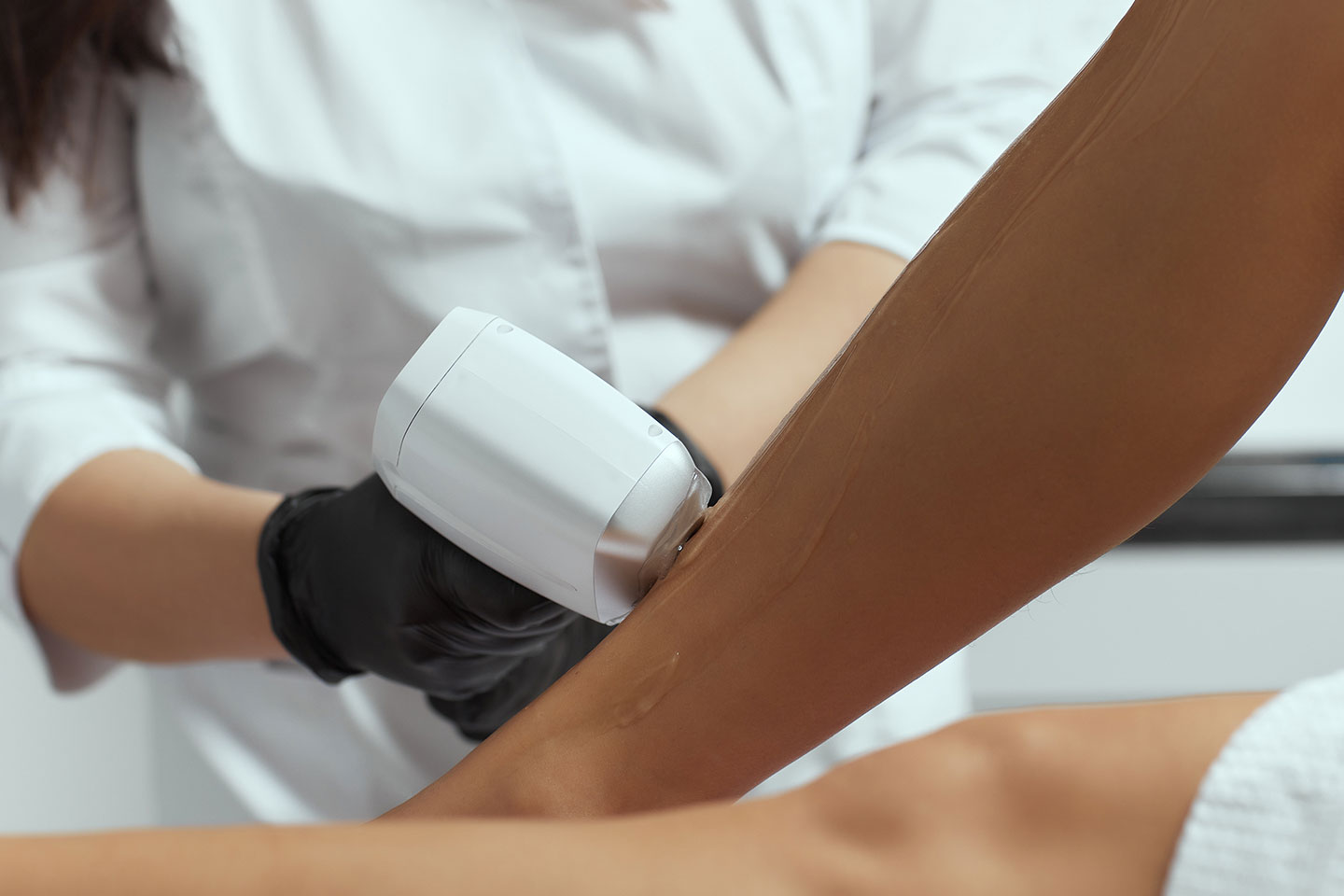 Permanent hårborttagning med laser vid Odenplan