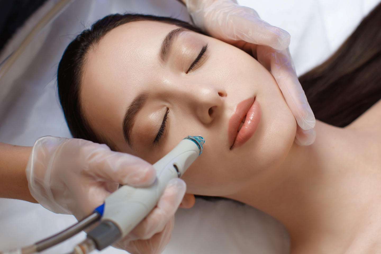 Hudföryngring Microneedling Dermapen 4, 1-2 tillfällen i Sundbyberg