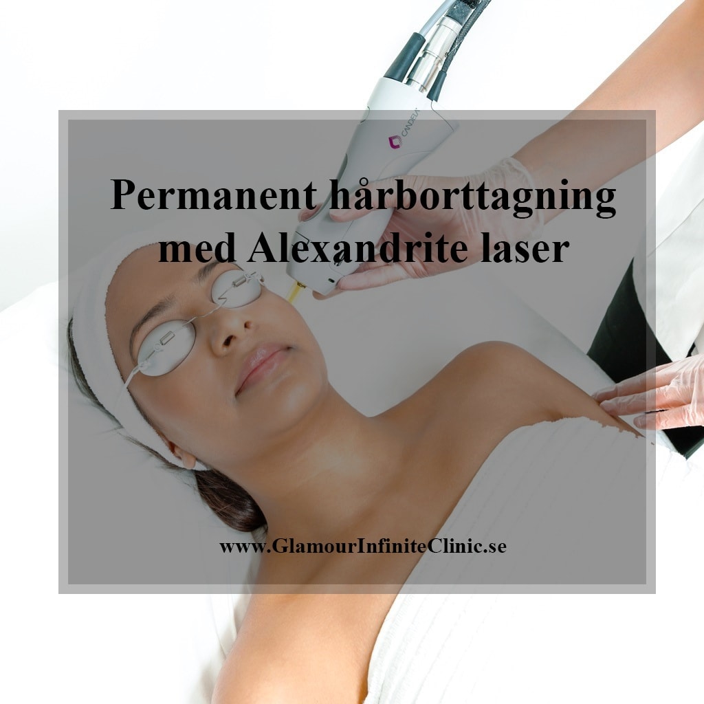 Permanent hårborttagning med alxeandritlasern hos Glamour infinite clinic (4 av 6)