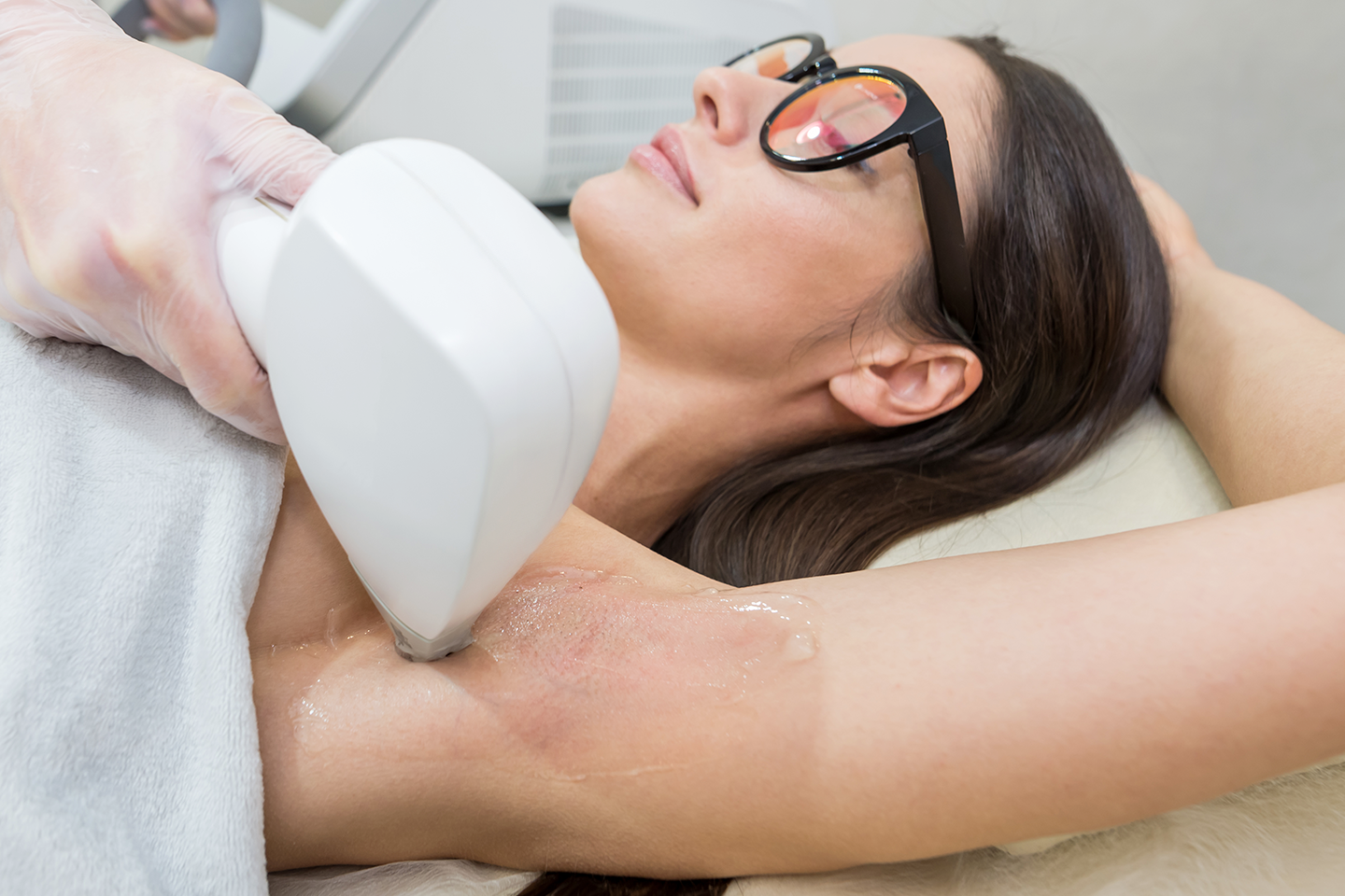 Permanent hårbortagning 4 tillfällen hos Aura Lab i Lund