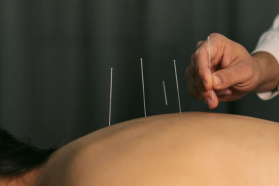 Massage el. akupunktur hos Akupunktur Pro Malmö vid Triangeln