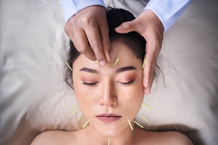 Kosmetisk akupunktur hos Akuveda Kliniken vid Odenplan