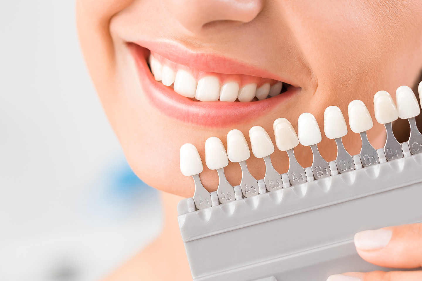 Tandblekning eller tandsmycke | Erbjudanden och rabatter online