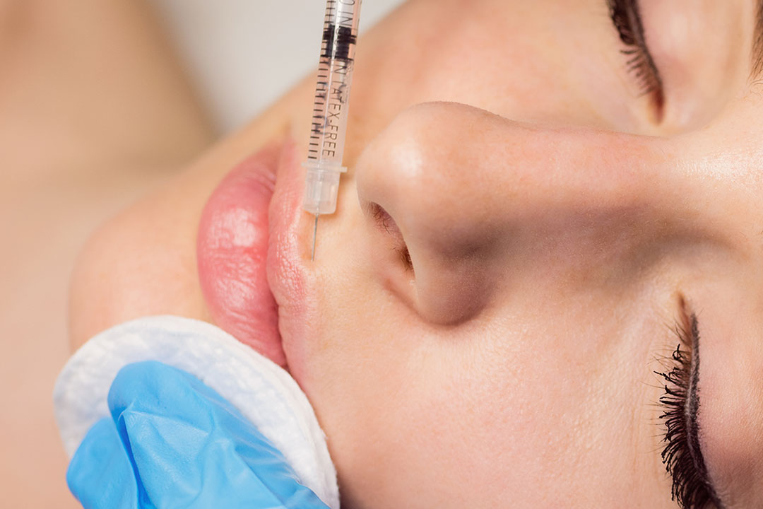 Paketpris: 1 ml fillers & 3 områden botulinumtoxin i Lundby