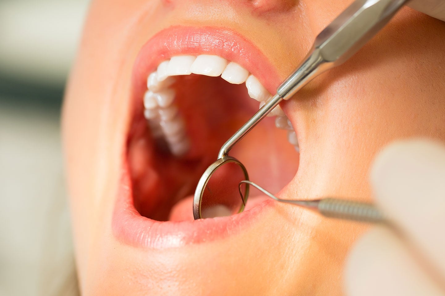 Tandundersökning inkl. röntgenbilder hos Dr V Tandklinik på Backaplan