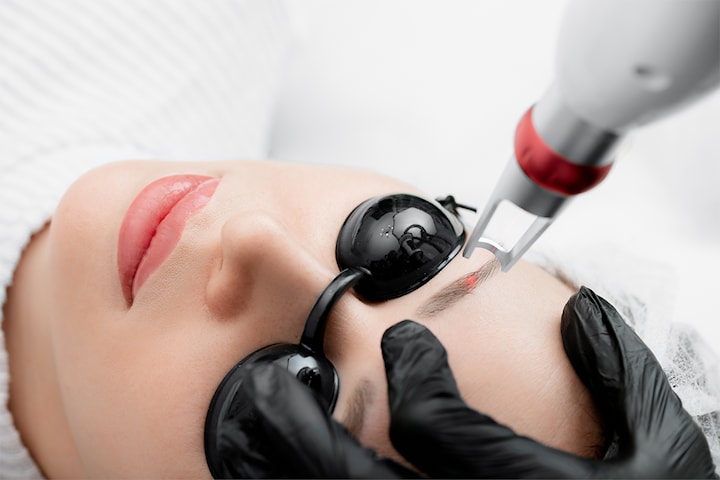 Fjerne tatoveringer og semi-permanent makeup hos The Beauty Hub
