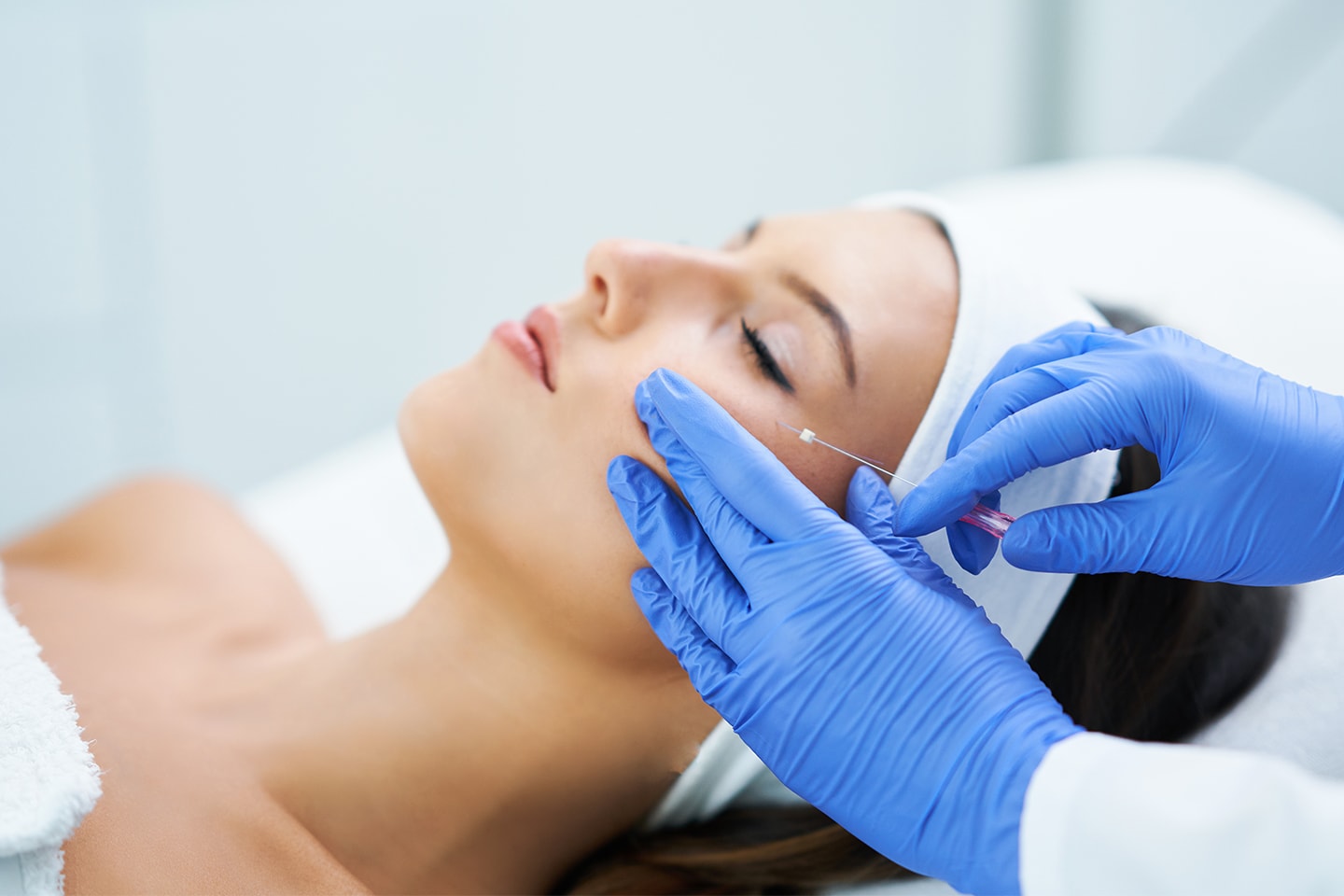 Stram opp løs hud i ansiktet med trådløft hos EstMed Klinikken (1 av 14)