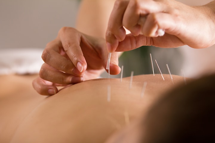 Akupunktur, massage eller ljusterapi