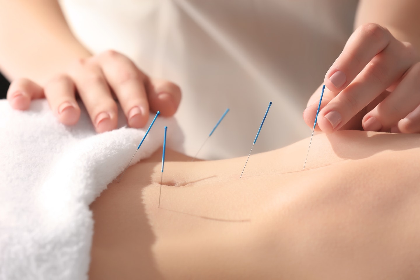 Hormonell balansering med akupunktur och örtbehandling (1 av 4)
