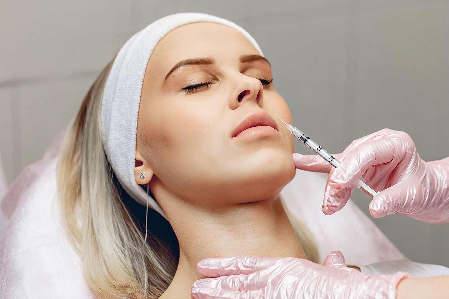 1,1 ml fillers inkl. 2 områden botulinumtoxin hos Biofiller Clinic i Haga