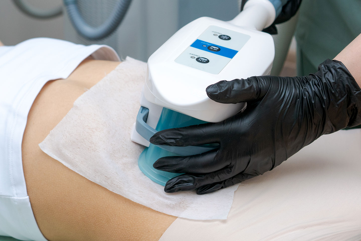 Fettfrysning 4 handenheter med cryolipolysis utan kirurgi