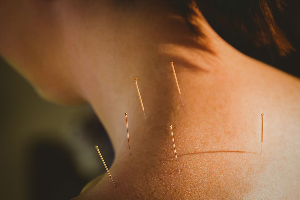 Akupunktur, akupressur, meditation och healing hos Norden KinaMedicin