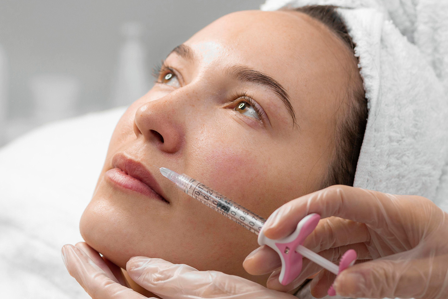 Fillers med Radiesse 1,5 ml vid Rambergsvallen