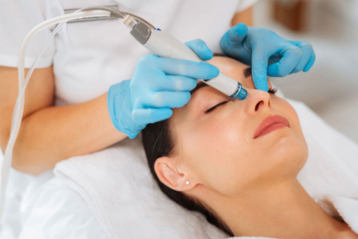 Få sunn og frisk hud med ulike ansiktsbehandlinger hos Esthetic Clinics (1 av 2)