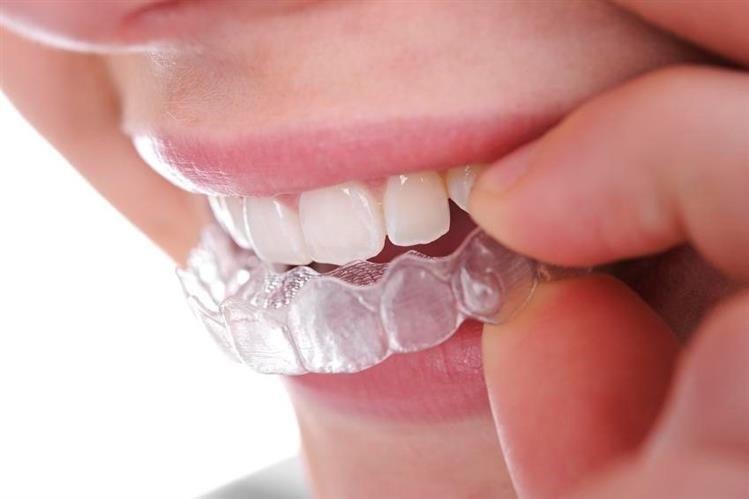 Avslappningsskena / Skyddsskena för tänder (2 av 5)