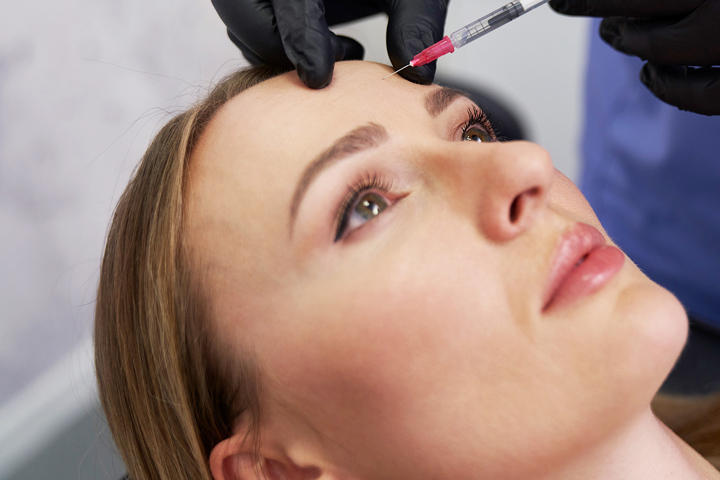 Profhilo: hudföryngrande behandling hos Naroon Vård i Kortedala