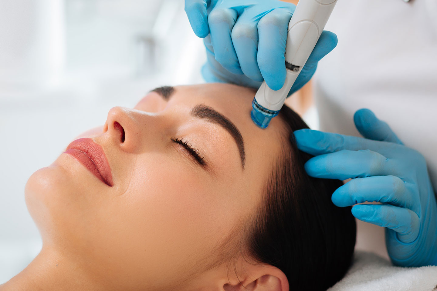 Microneedling Lax DNA för glow och hudföryngring i Upplands Väsby