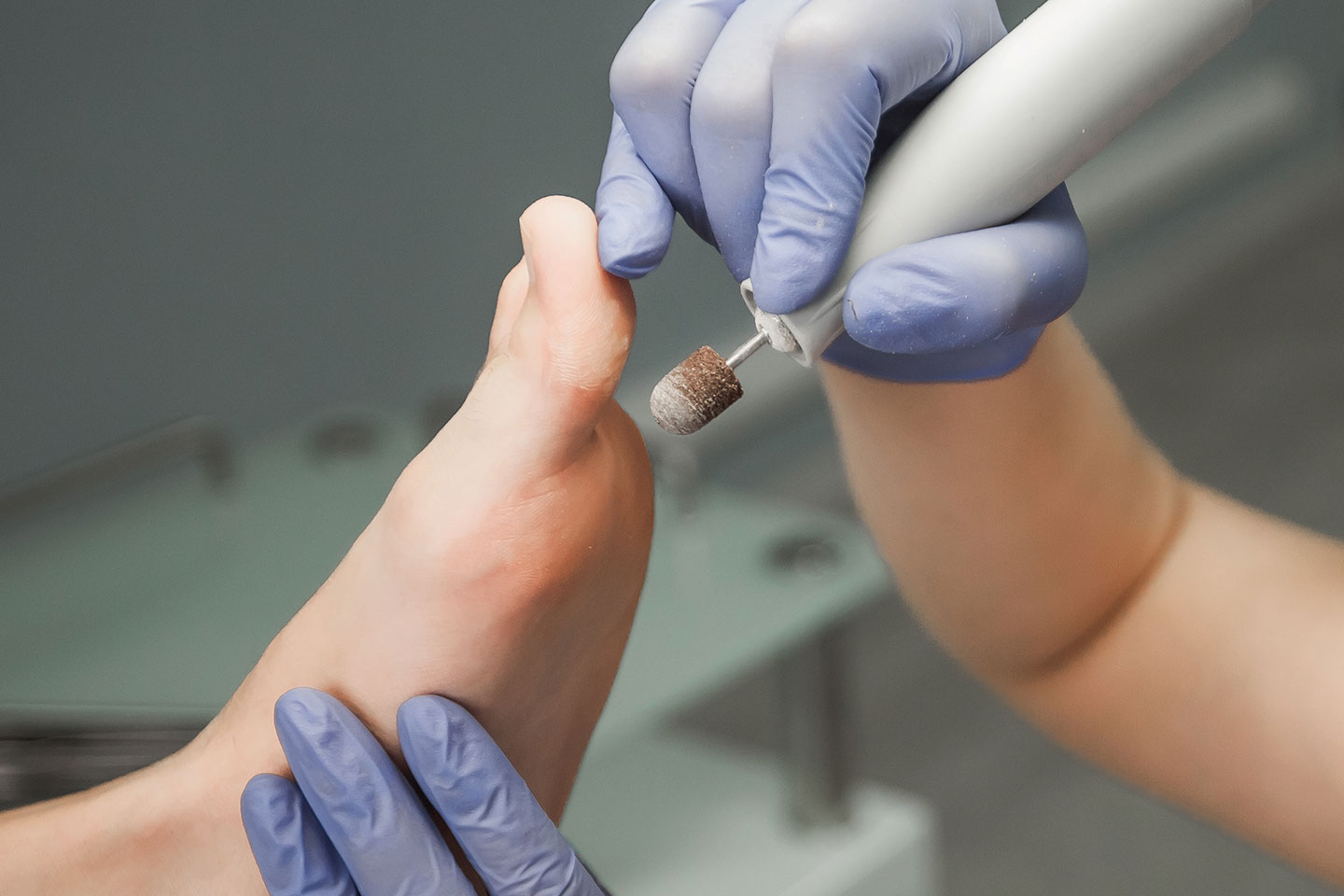 Medicinsk fotvård 60 min hos Dermacare Klinik vid Ramberget