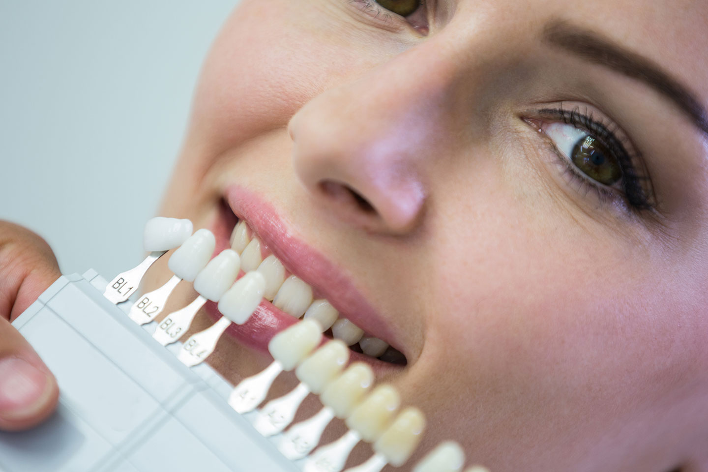 Tandblekning med laser hos Tota Estetiska på Kungsholmen