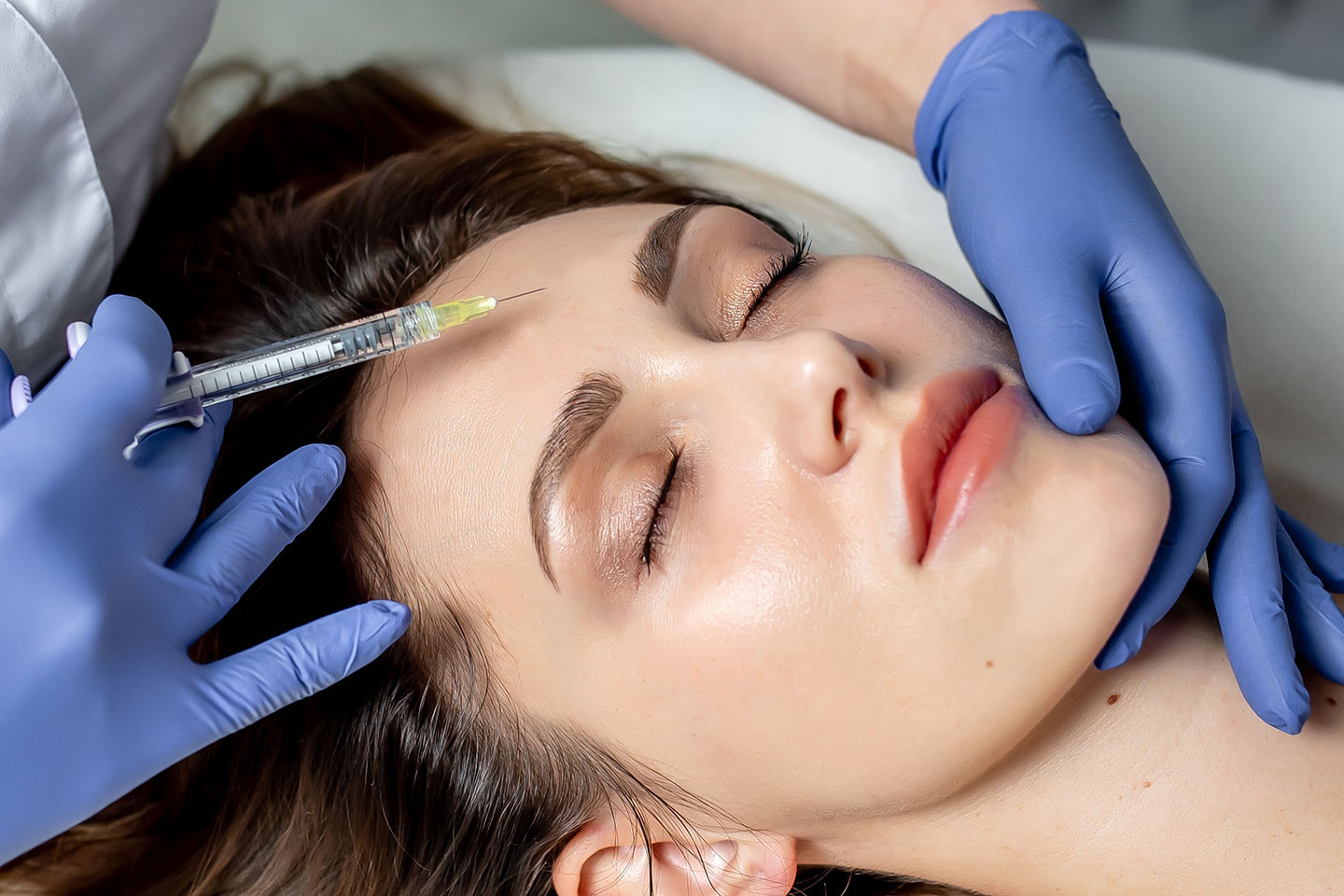 Botulinumtoxin 1-3 valfria områden hos Frida Beauty & Estetik, Bromma