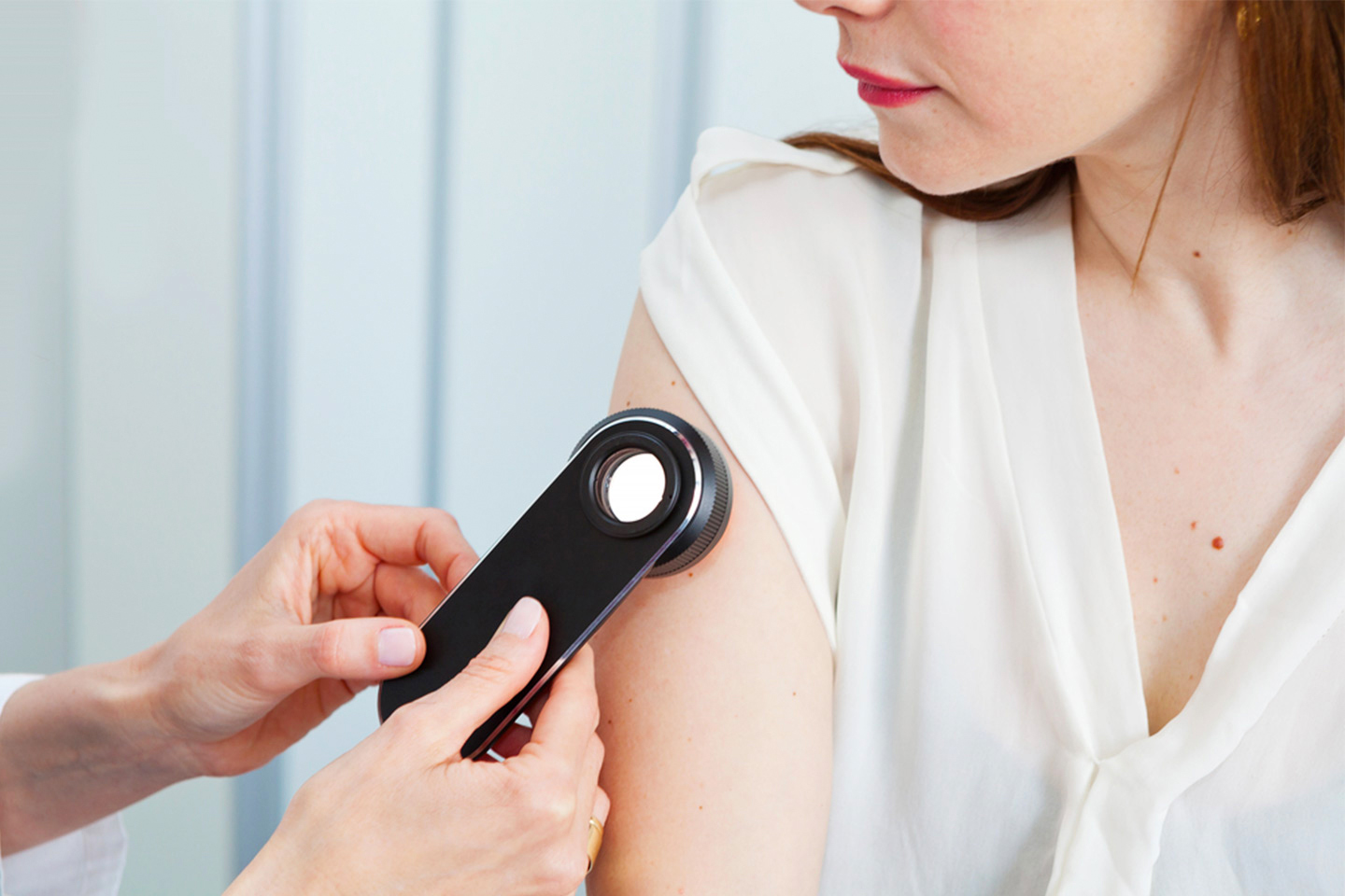Ta bort födelsemärken, fibrom eller vårtor i Bromma