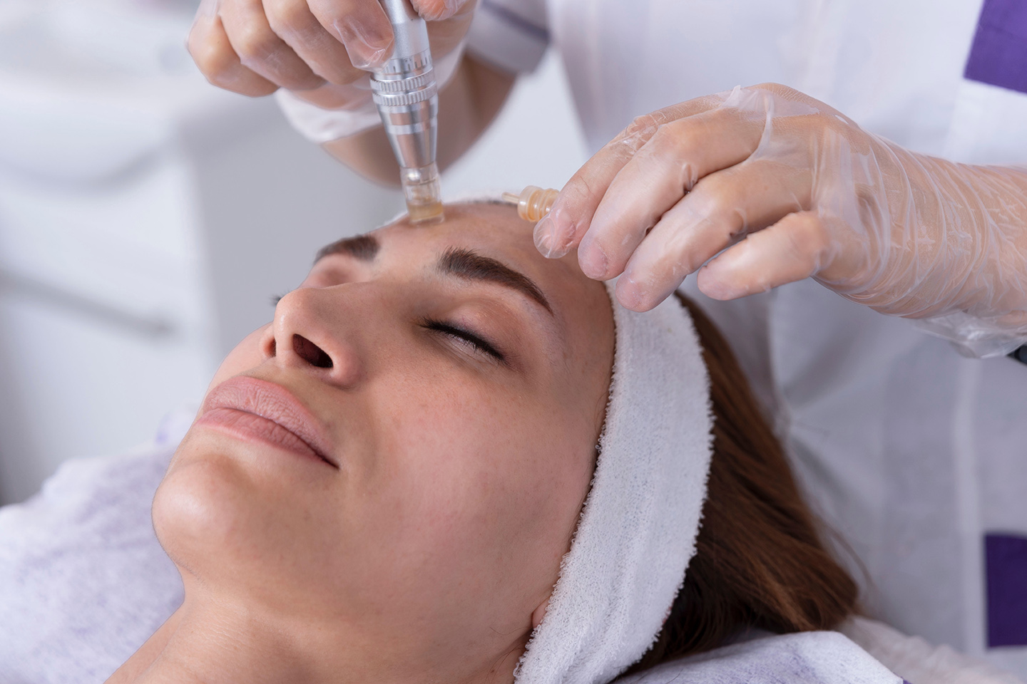 Microneedling med Dermapen, serum och LED-terapi i Sundbyberg