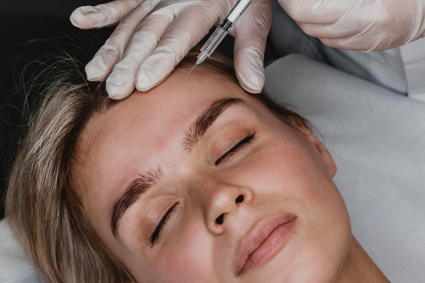 NUA Lift Sculptra injektionsbehandling hos Nua Clinic i Vasastan